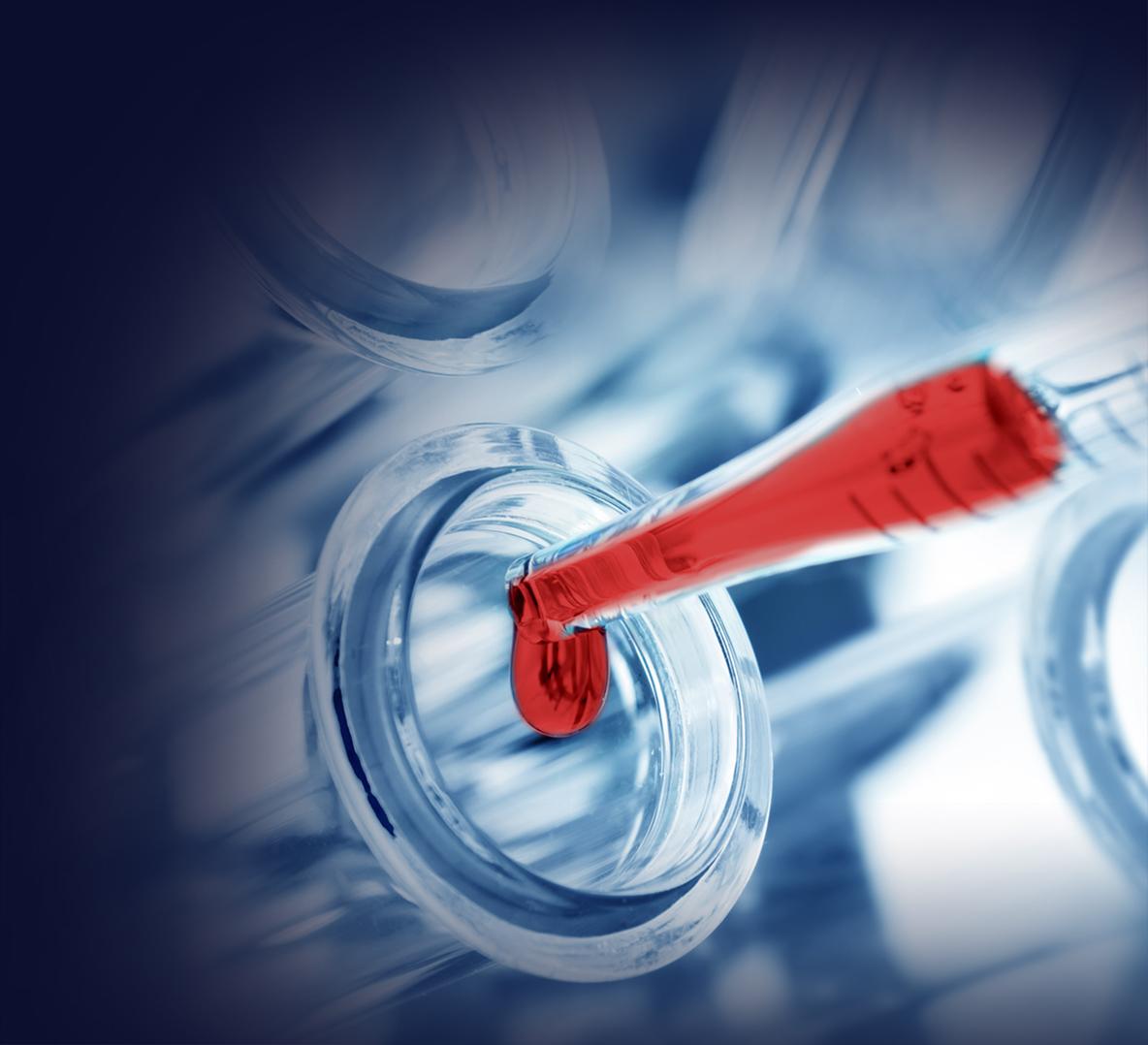 Dépôt de prélèvement